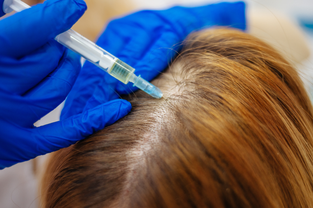 Hair growth stimulation treatment