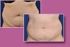 Body-Jet Case Study